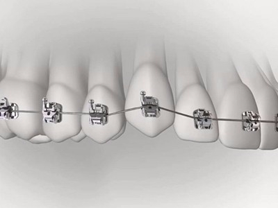 承德市哪家口腔醫(yī)院口腔正畸做得好？惟德口腔醫(yī)院來(lái)告訴您